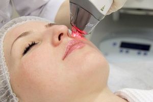 Proceso de rexuvenecemento da pel da cara mediante un láser fraccionado